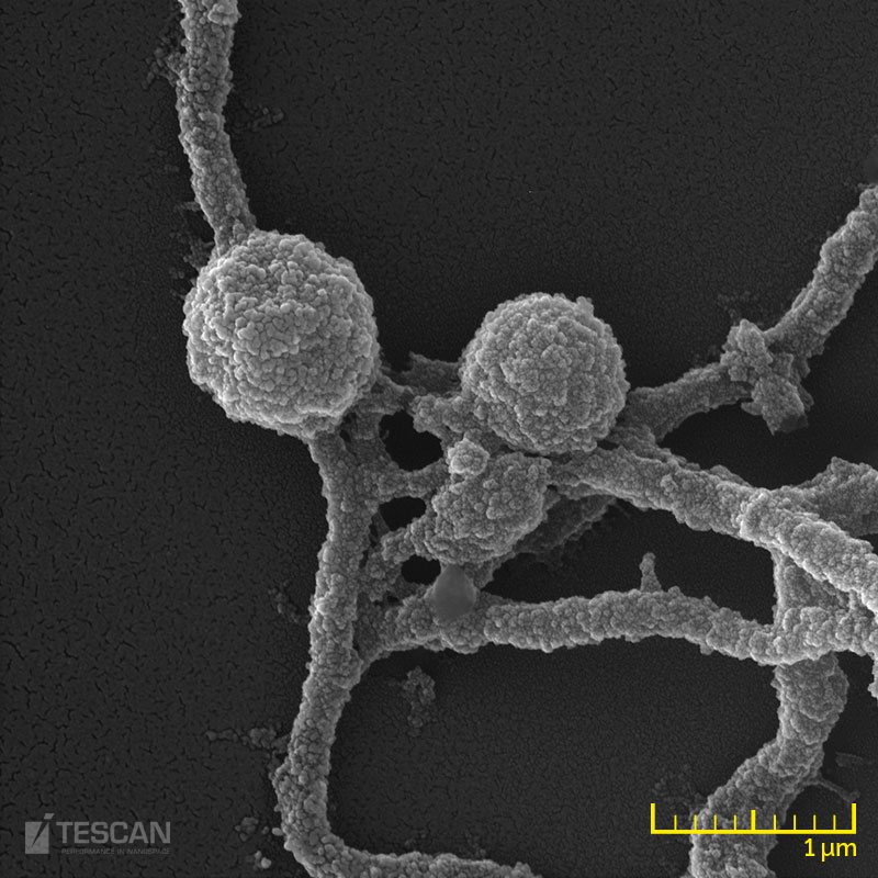 Microphotograph of Borrelia spp.