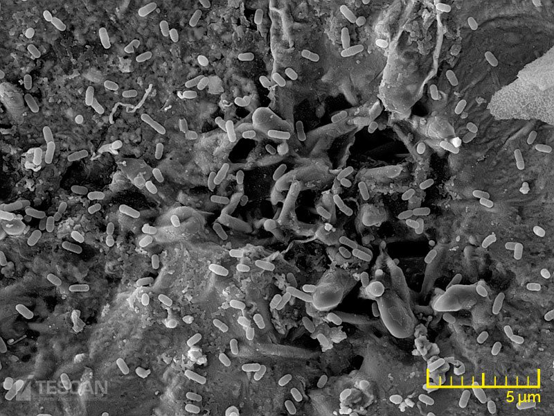 Streptococcus mutans on dental filling