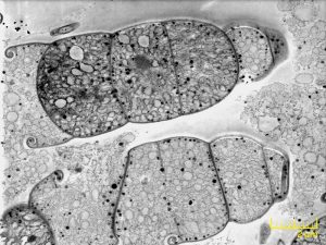 STEM Image of cyanobacteria