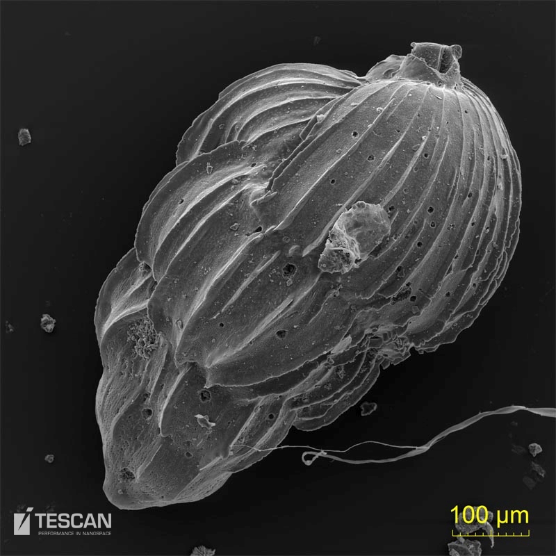 Foraminifera - uvigerina