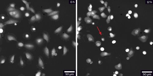 Changes in morphology of LNCaP cells treated with DOX. Red arrow indicates an example of dead cell in QPI image.
