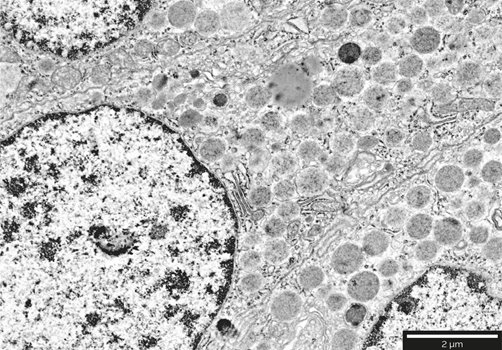 Localization of secretory granules of somatostatinoma tumor cells in pancreatic tissues. Images acquired at 2 keV.