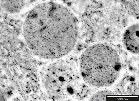 Localization of secretory granules of somatostatinoma tumor cells in pancreatic tissues. Images acquired at 2 keV.