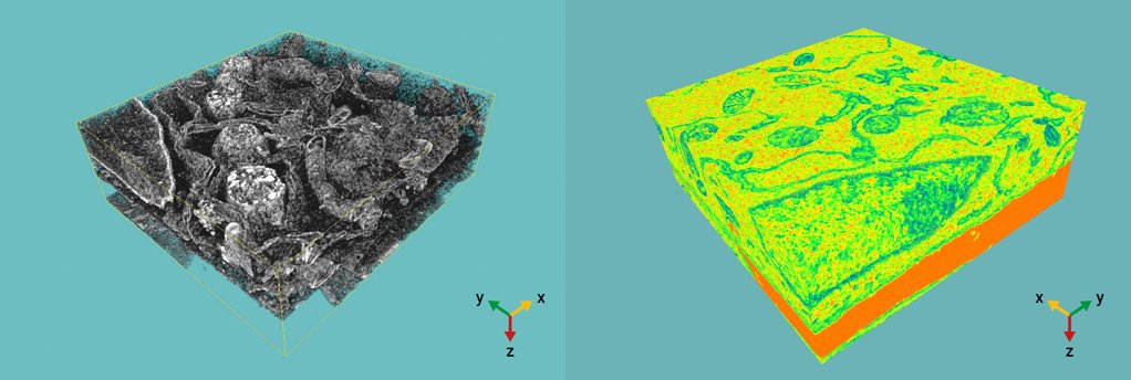 3D ultrastructural reconstruction of studied mammalian cell. Selected FIB-SEM stacks show intracellular organization with clear contacts between organelles.