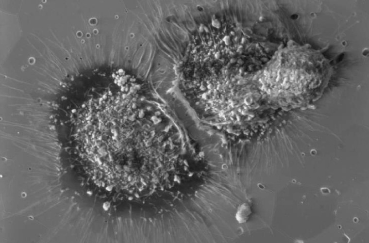 Spreading of the osteoblasts on the zirconia ceramics