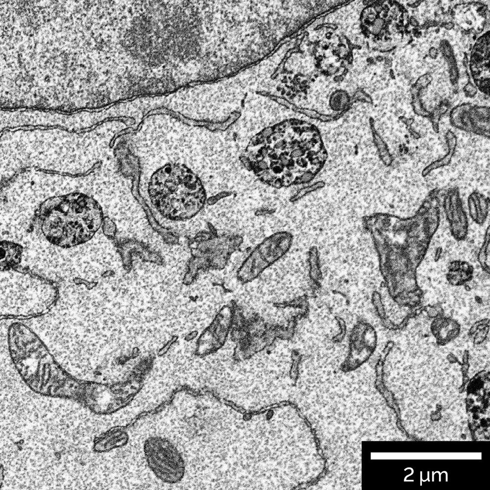 Resin embedded mammalian cells. Additionally inverted image was acquired using In-Beam BSE detector at accelerating voltage 2.5 keV