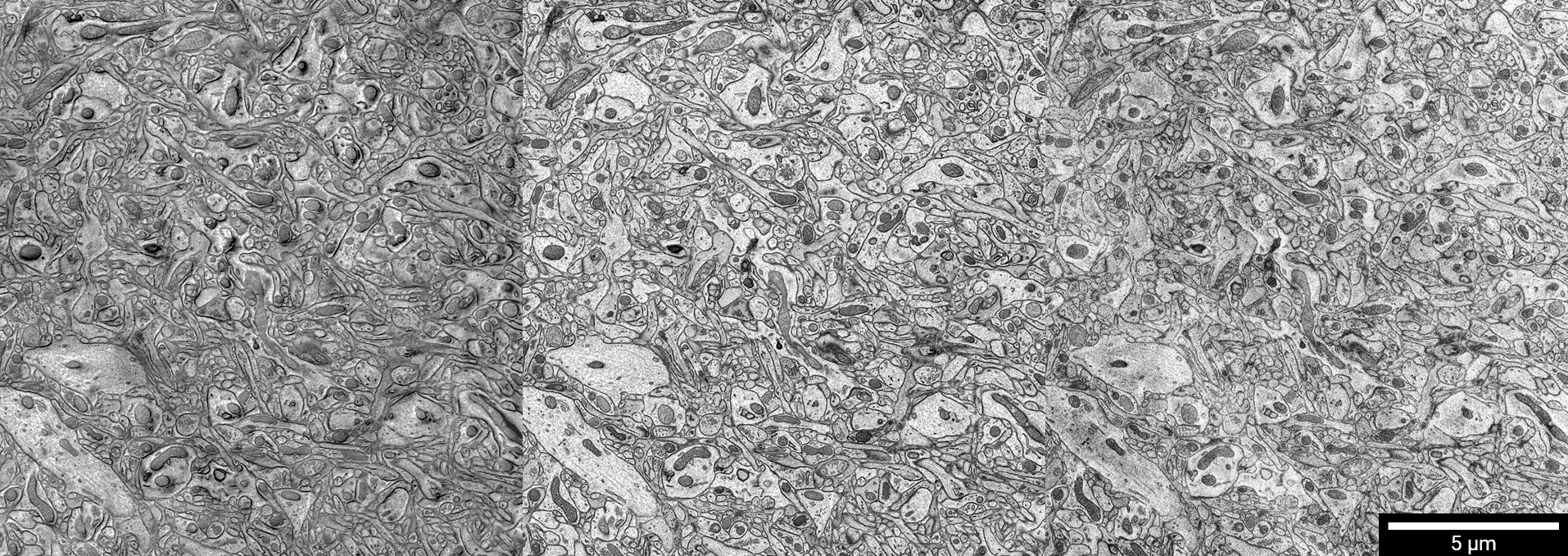 Resin-embedded brain tissue. The ultrastructure was visualised using In-chamber E-T detector (left), Low-energy BSE detector (centre) and high-resolution Axial BSE detector (right) at beam energy of 2 keV.